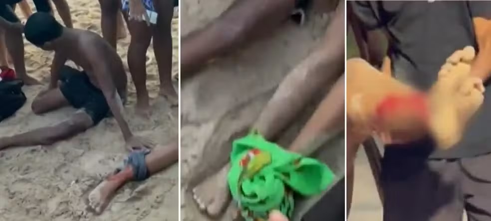 Ataque de peixes-espada deixa feridos em Rio das Ostras