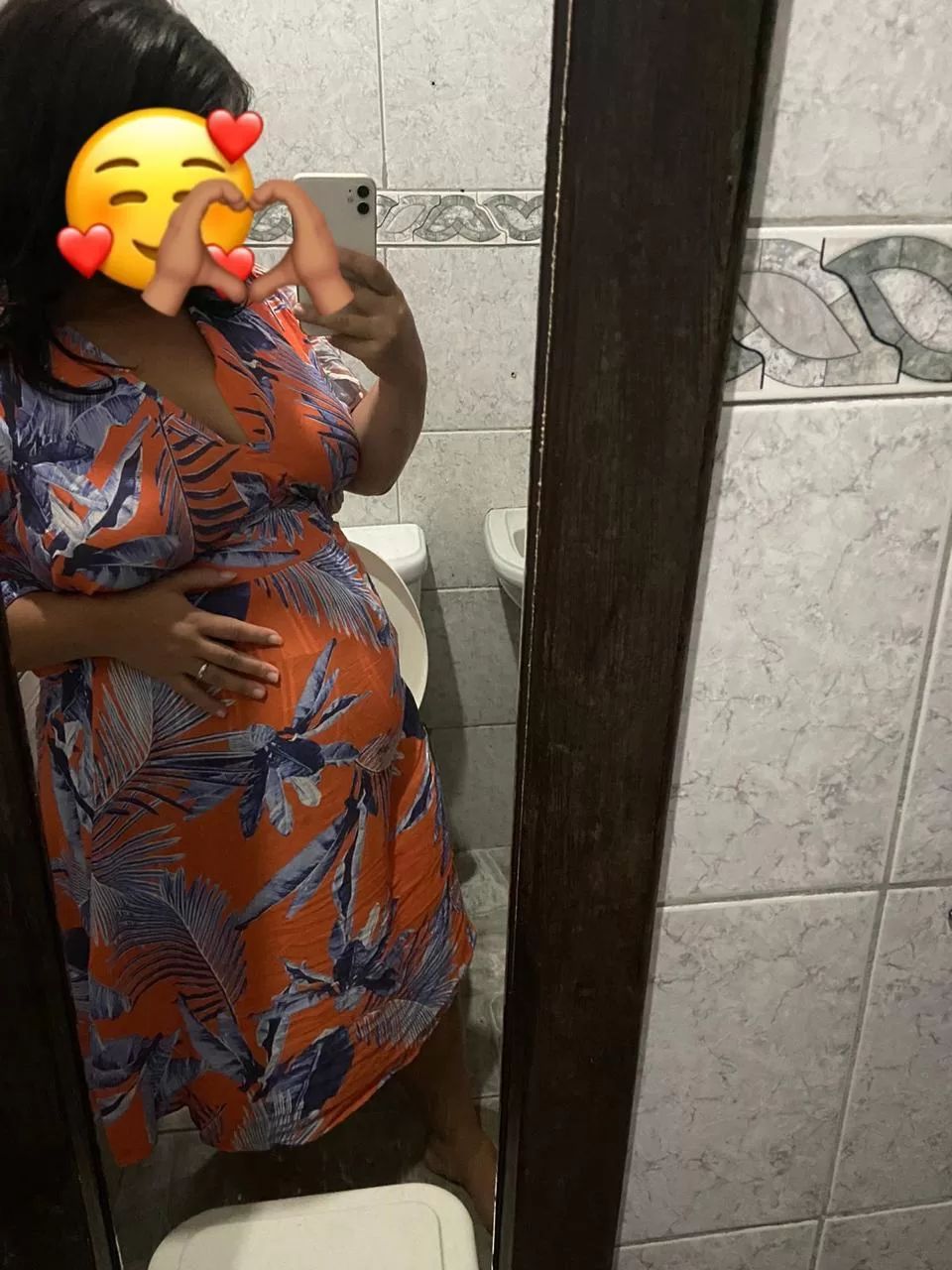 Jovem passa por cesárea sem estar grávida; Prefeitura de Cabo Frio se posiciona