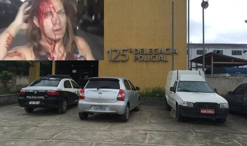 Suposto caso acaba em tentativa de feniminicio de São Pedro da Aldeia