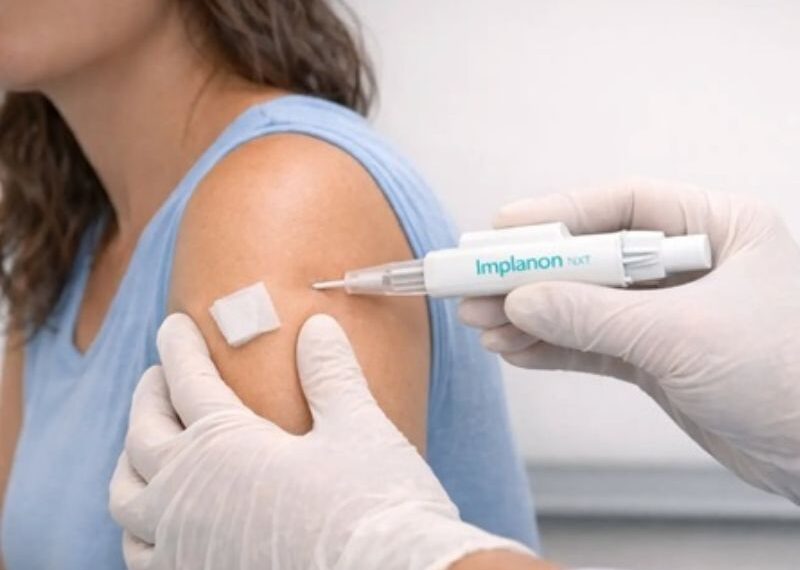 Clínica da Mulher oferece contraceptivo subdérmico para mulheres de Saquarema