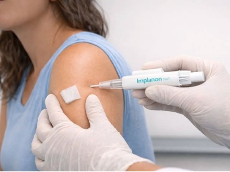 Clínica da Mulher oferece contraceptivo subdérmico para mulheres de Saquarema